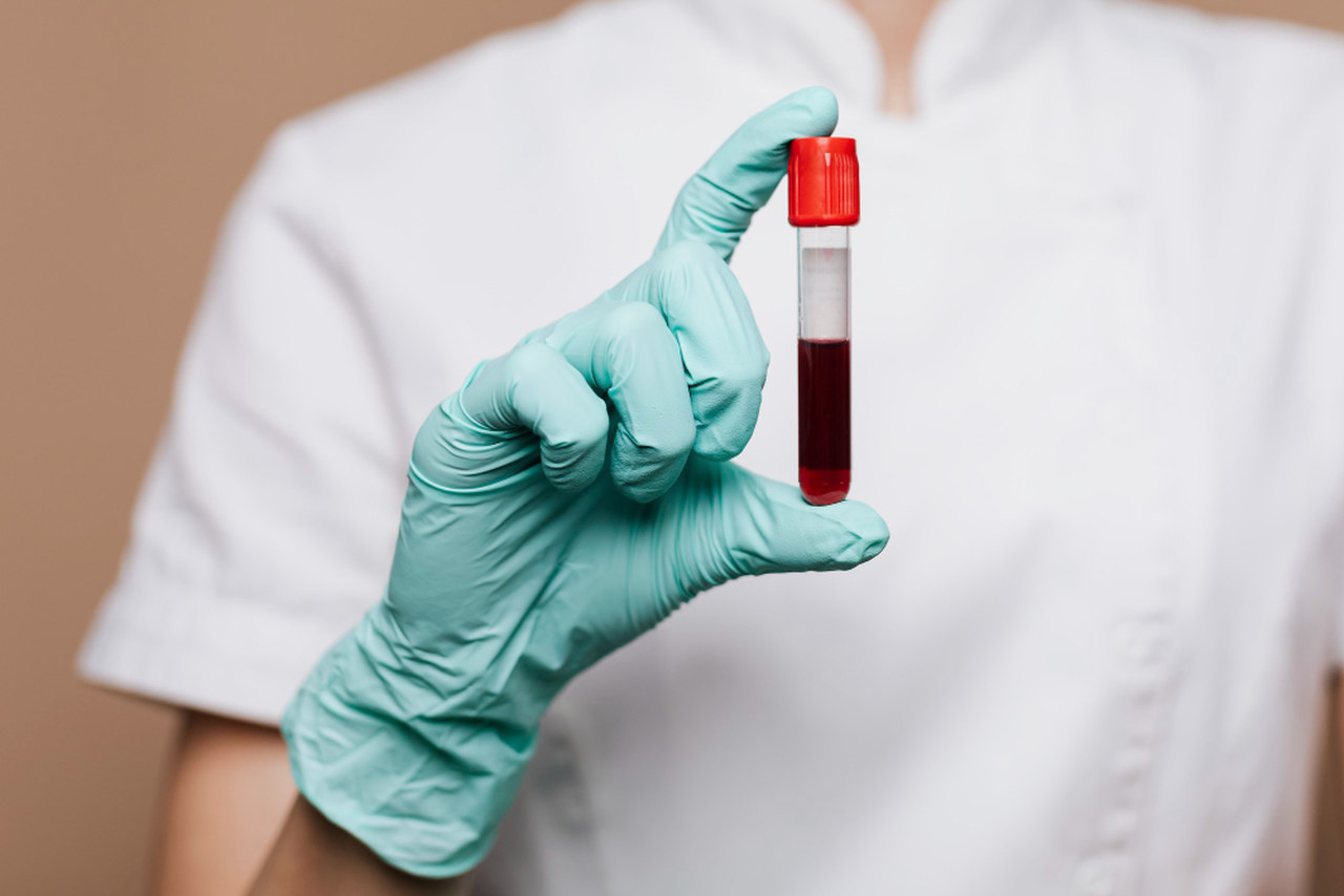 Para que serve o exame toxicológico - coleta de amostra capilar